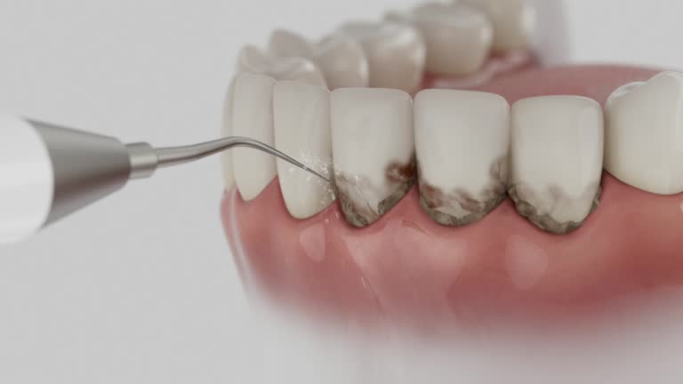 Reliable Tooth Extraction contractor in Big Bear Lake, CA by Smile Center Dentistry